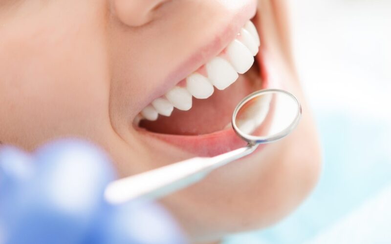 Tips to Prevent Oral Diseases and Maintain a Healthy Smile